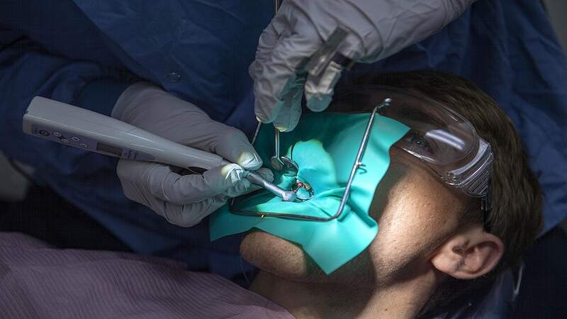 All-on-6 Dental Implants