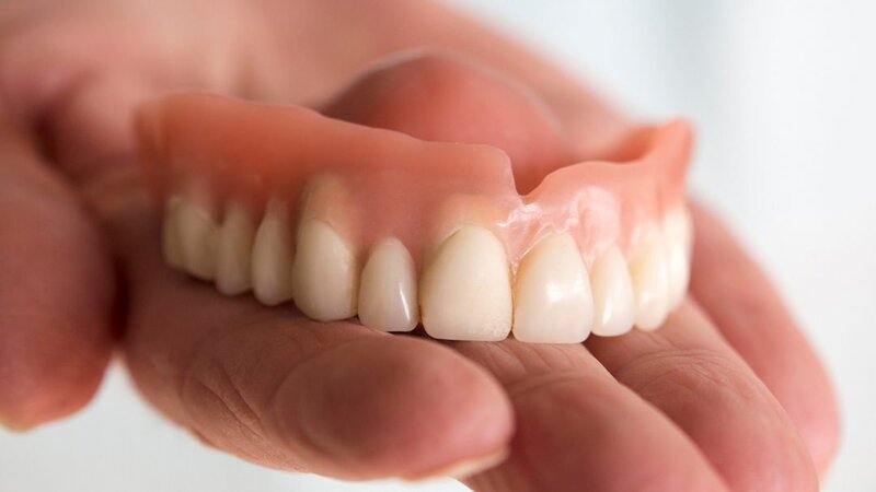 Snap-On Dentures