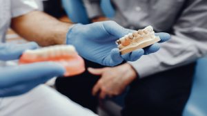 Bridge vs Implant: Bridging the Gap in Tooth Replacement Options