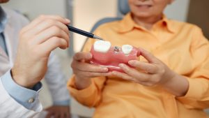 Discover the Benefits of Snap-On Dentures with Implants: A Guide from Dentist in Leek