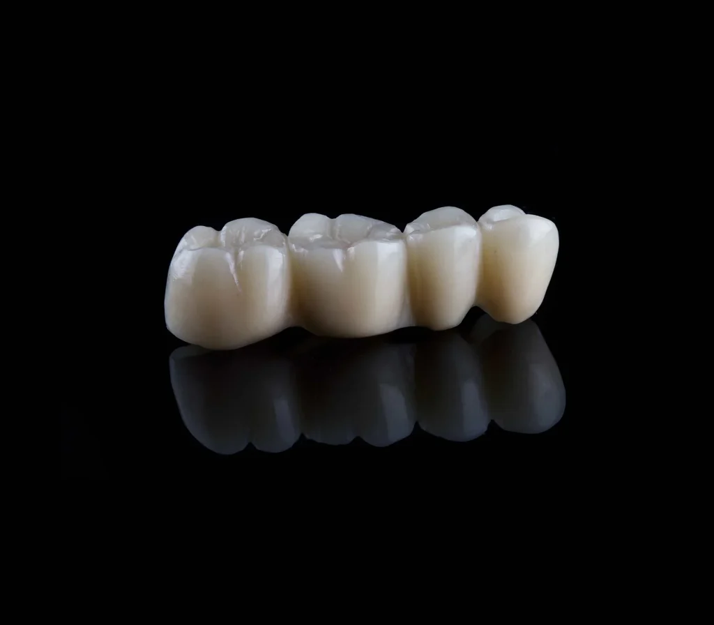 dental crown