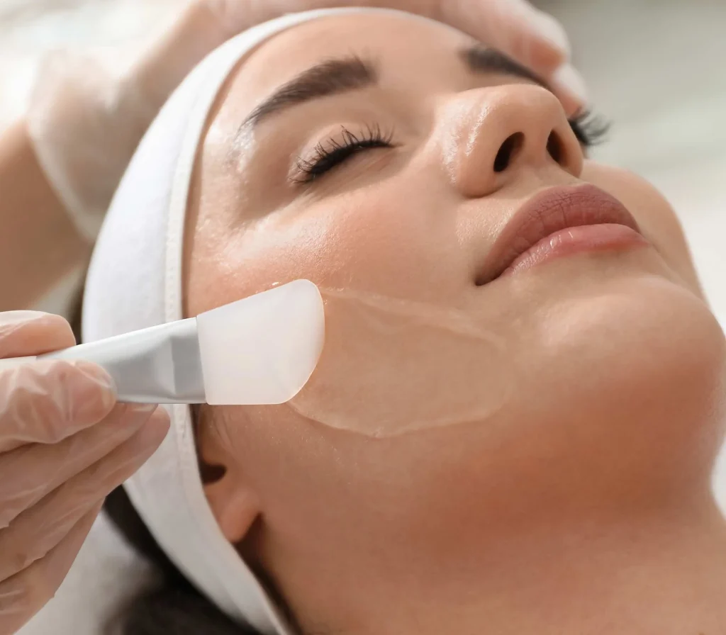 skin peels